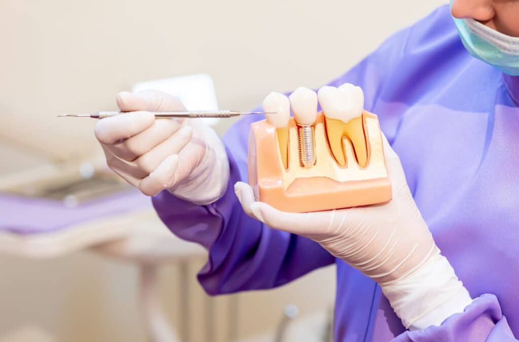 dental-implant-3-1024x674.jpg имплант зуба
